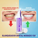 Blanqueador Dental Morada v34
